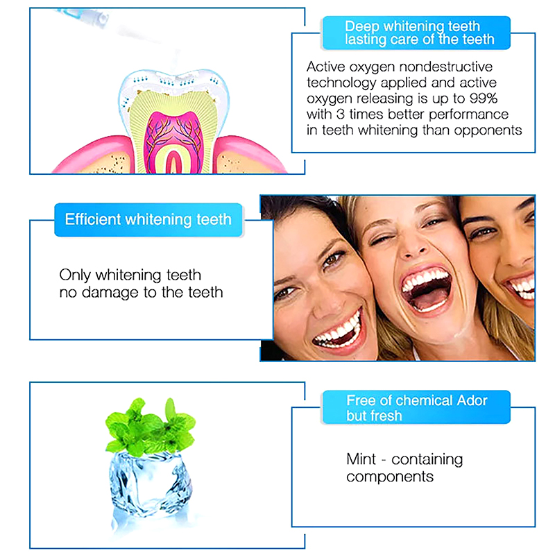 Teeth Whitening Pen Profession - Teeth Whitening Bleaching Kit review and price