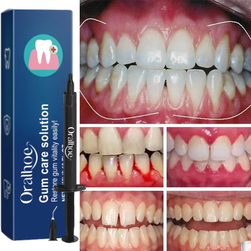 Teeth Whitening Gel Gum Repair - Teeth Whitening Gel review and price