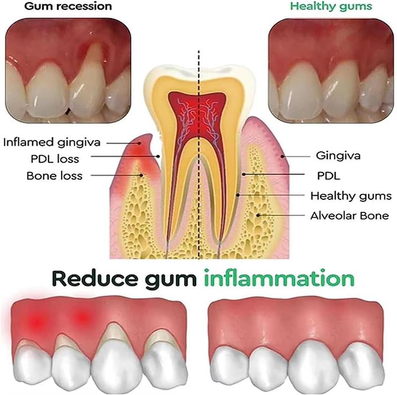 Teeth Whitening Gel Gum Repair - Teeth Whitening Gel review and price